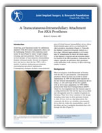 A Transcutaneous Intramedullary Attachment For AKA Prostheses