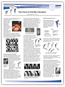 The Science Behind a Short (Neck Preserving) Curved Stem Total Hip Replacement