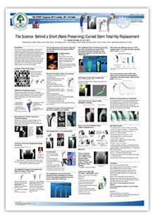 The Science Behind a Short (Neck Preserving) Curved Stem Total Hip Replacement