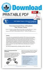 Unicompartmental Knee Arthroplasty Past Present Future