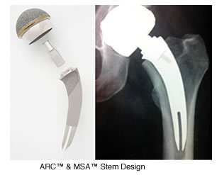 Arc and Msa Steam Design