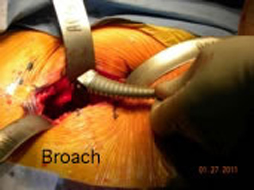 broach-img