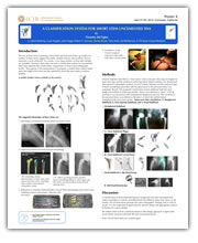 A Classification System For Short Stem Uncemented THA