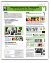 Early Learning Experience with a Neck Stabilized THA Stem for Treating Osteoarthritis
