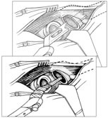 modular-neck-stem-img1