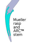 muller-rasp-arc-stem-img