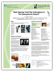 Neck Sparing Total Hip Arthroplasty In The Osteoporosis Patient