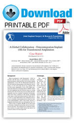 Osteointegration Implant (OI) for Transfemoral Amputation - download