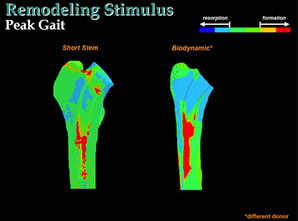 remodeling-stimulus-img1