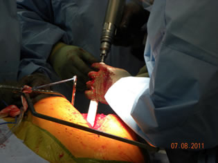 surgical-technique-perls-img7