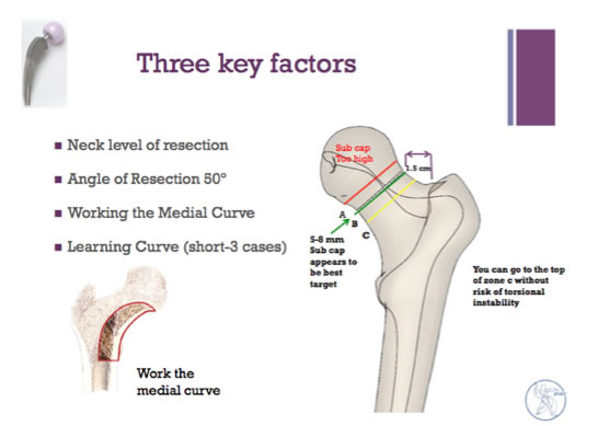 three-key-factors-img