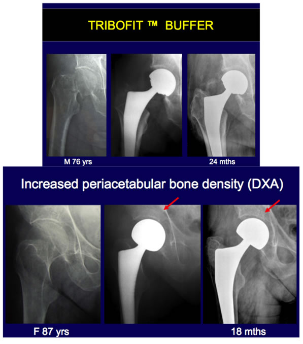 tribofit-buffer-img